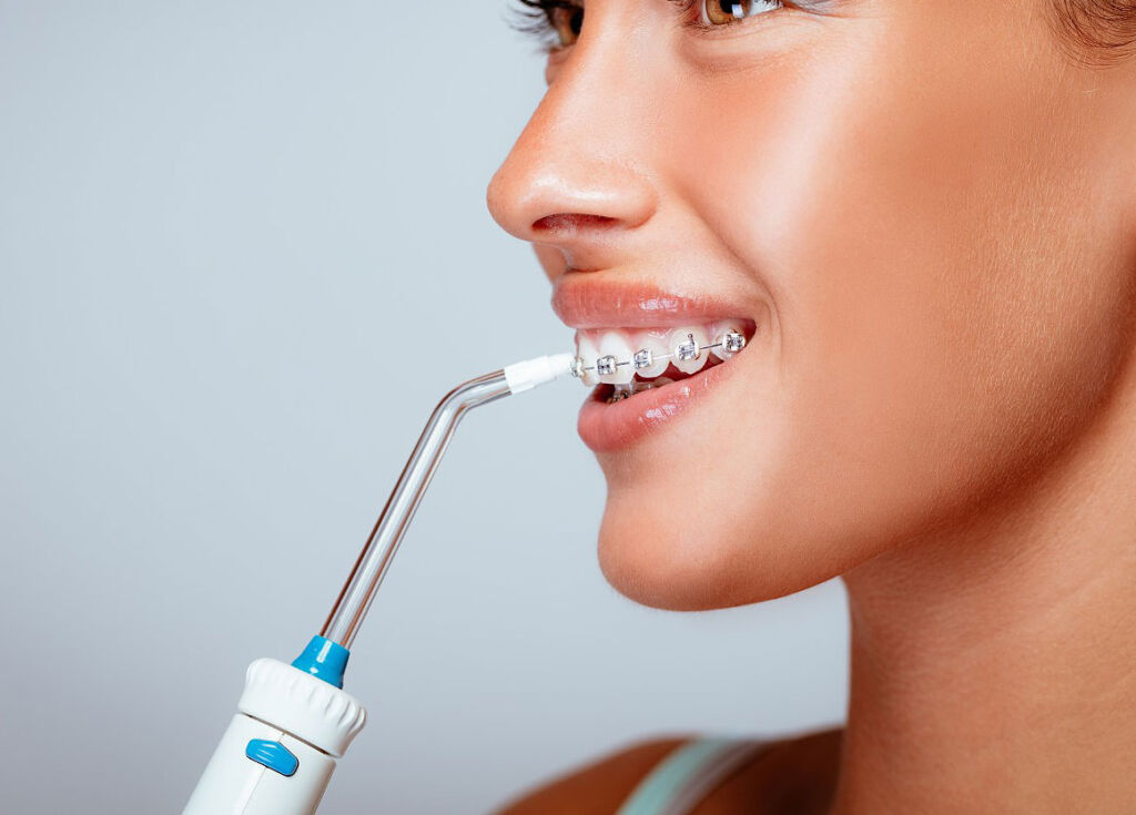 Woman using a water flosser while wearing braces