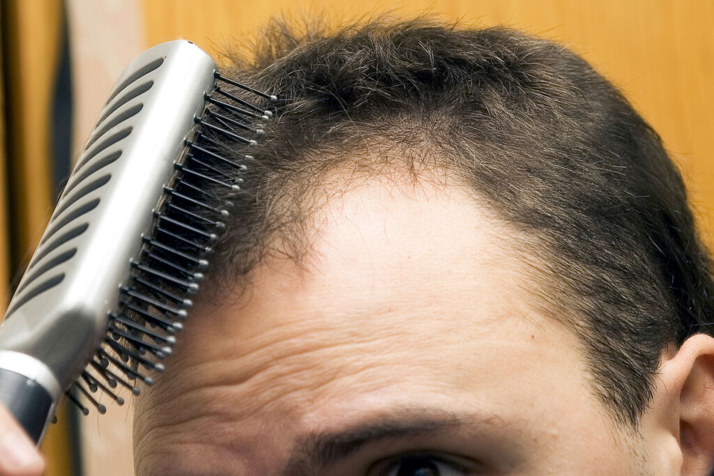A man brushing, worried about his hair loss